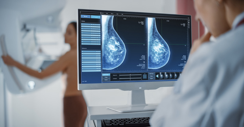 What to Expect When Getting Your First Mammogram