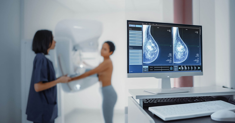 What You Need To Know About Breast Cancer And Life Insurance